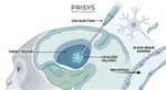 Services d'injection intracérébrale de PSN (ICM)|Prisys Biotech